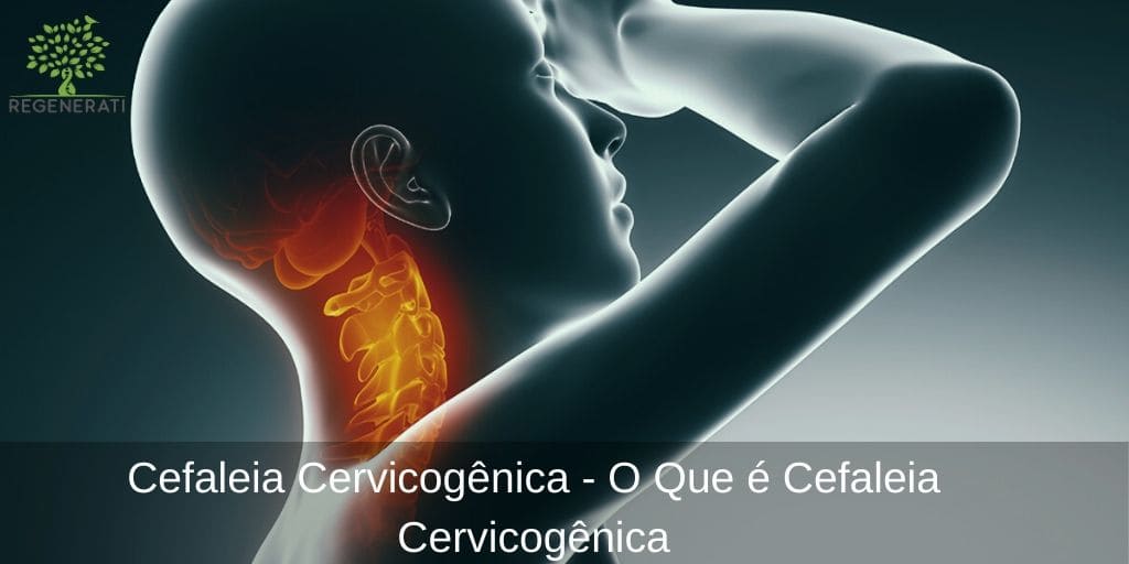 Cefaleia Cervicogênica - O Que é Cefaleia Cervicogênica Cefaleia Cervicogênica - O Que é Cefaleia Cervicogênica
